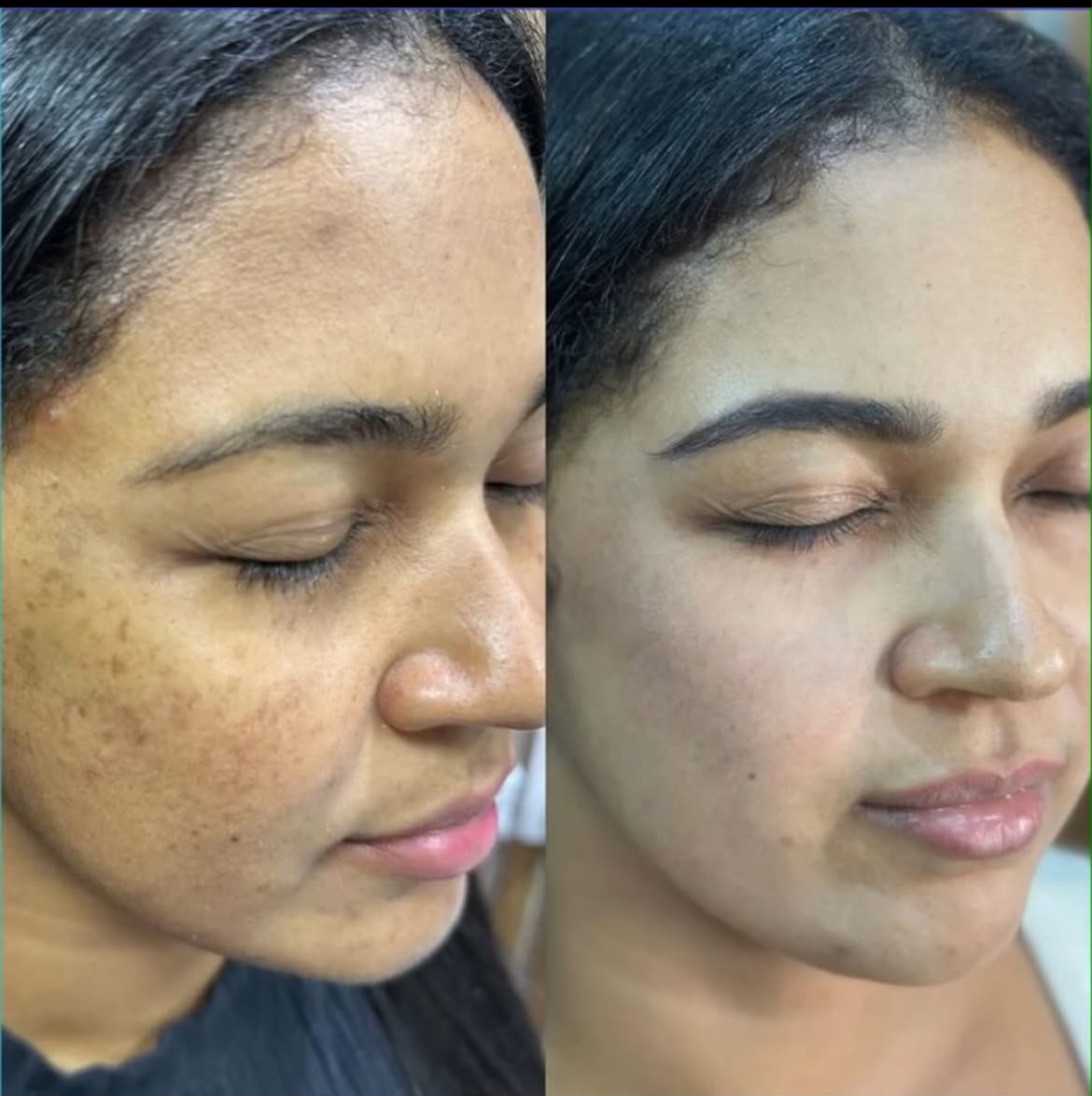 Inaya Bridal Night Cream – Glowing Results