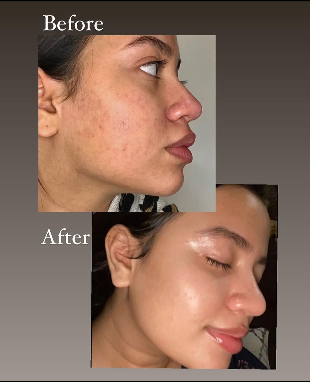 Inaya Bridal Night Cream – Glowing Results