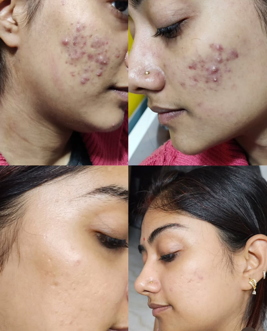 Inaya Bridal Night Cream – Glowing Results
