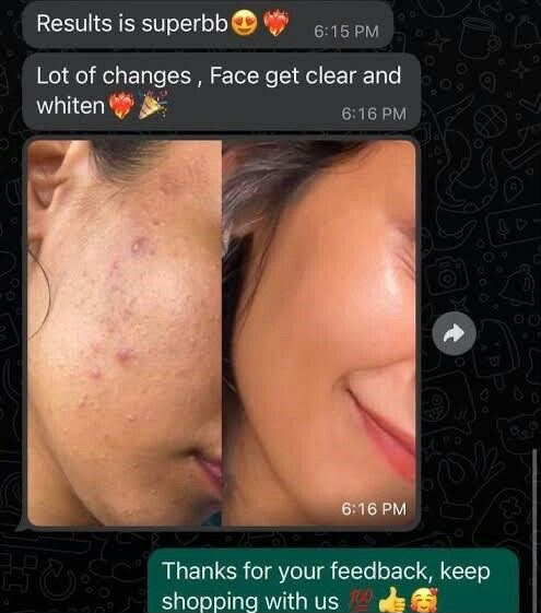 Inaya Bridal Night Cream – Glowing Results